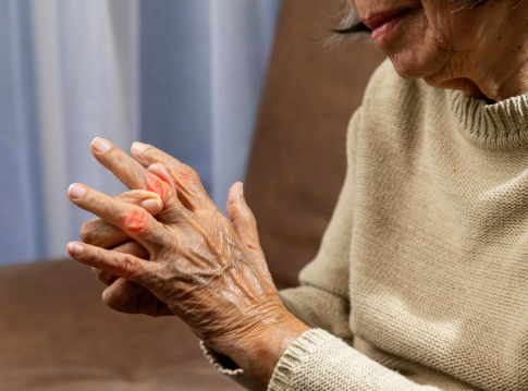 Hand affected by essential tremor